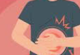 Image of Intestinal Cramps