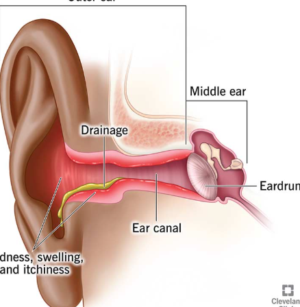 Image of an Outer Ear